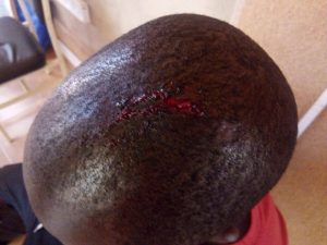 Ouagadougou: Un citoyen passé à tabac par un…