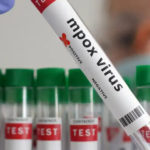 Côte d’Ivoire : 28 cas de Mpox recensés, dont un mort/ Épidémie de mpox