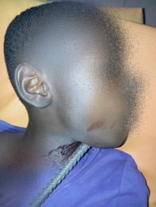Sauvetage médical à Ouagadougou : un enfant de 10 ans tiré d’affaire après un accident grave