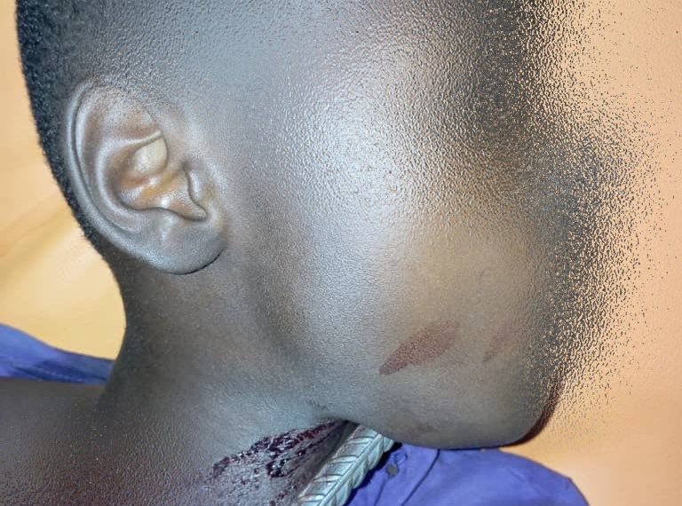 Sauvetage médical à Ouagadougou : un enfant de 10 ans tiré d’affaire après un accident grave