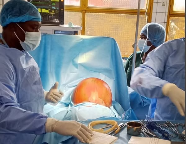 Kyste ovarien de 14 kg au CHR de Dédougou : une intervention médicale exceptionnelle